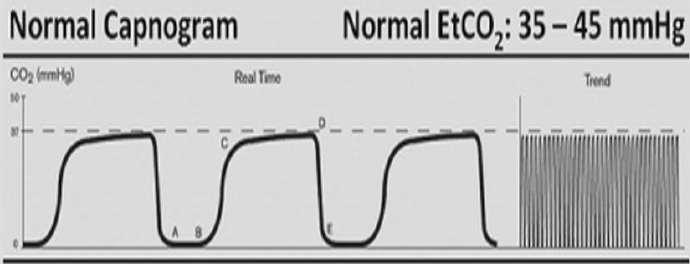 Ekspiratuar CO 2 nin izlenmesi (EtCO 2 =35-45 mmhg) ETT yerinin belirlenmesi Ventilasyon Geri soluma Kalp debisi Kan akımının dağılımı Metabolik