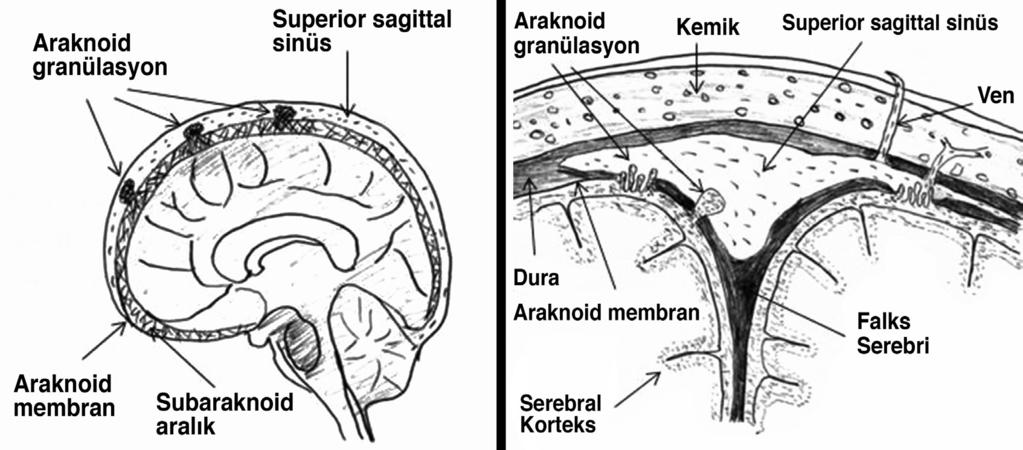 Dilaver Kaya; Serebral Venöz Sinüs Trombozu anatomik boşluklardır ve damar duvarı içermezler.