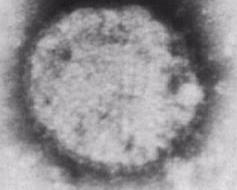 Rhabdovirus