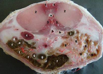 quadratus lumborum, a)medulla spinalis, b)aorta abdominalis, c)ren sinister, d)jejunum, e)duodenum, f)colon ascendens,