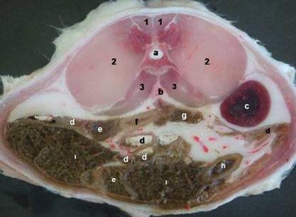 quadratus lumborum, a)medulla spinalis, b)aorta abdominalis, c) Ren sinister, d)jejunum, e)colon ascendens, f) Ileum,