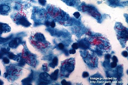 Mycobacterium tuberculosis Robert Koch (1882'de)Tüberküloz hastalığının Mycobacterium tuberculosis tarafından oluşturduğunu kanıtladı Asit- alkole dirençli Gram yöntemi il zor boyanırlar