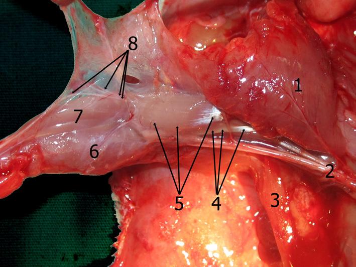 kaburganın dış yüzü, arka kenarını ise scapula nın (kürek kemiği) margo superior u (Şekil 6) yapar. Basisi: Önde m.pectoralis superficialis in (Şekil 1,3,4,12) alt kenarı ile m.