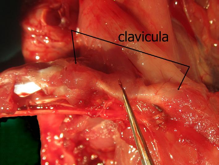 Aksillanın anterior ve posterior duvarlarının birleşim köşesinde aksiller damar-sinir paketi (Şekil 7), vagina axillaris adlı kılıf içinde sarılı olarak bulu- Şekil 5.