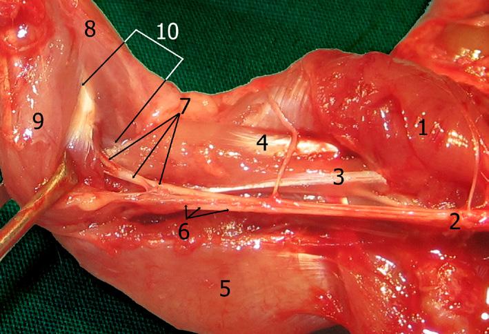 medianus (Şekil 9,12,13) (önkol bölgesindeki ve eldeki bazı fleksör kasları inerve eder), -N.pectoralis medialis (Şekil 10,11,12) ve n.pectoralis lateralis (Şekil 11,12) (m.