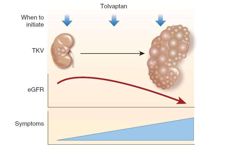 Tolvaptan Tedavisine Ne Zaman