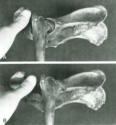 6 Cranioventral luksasyonlarda ise caput femoris, eminentia iliopubica nın cranial kısmına çengel gibi sıkışmış durumdadır.