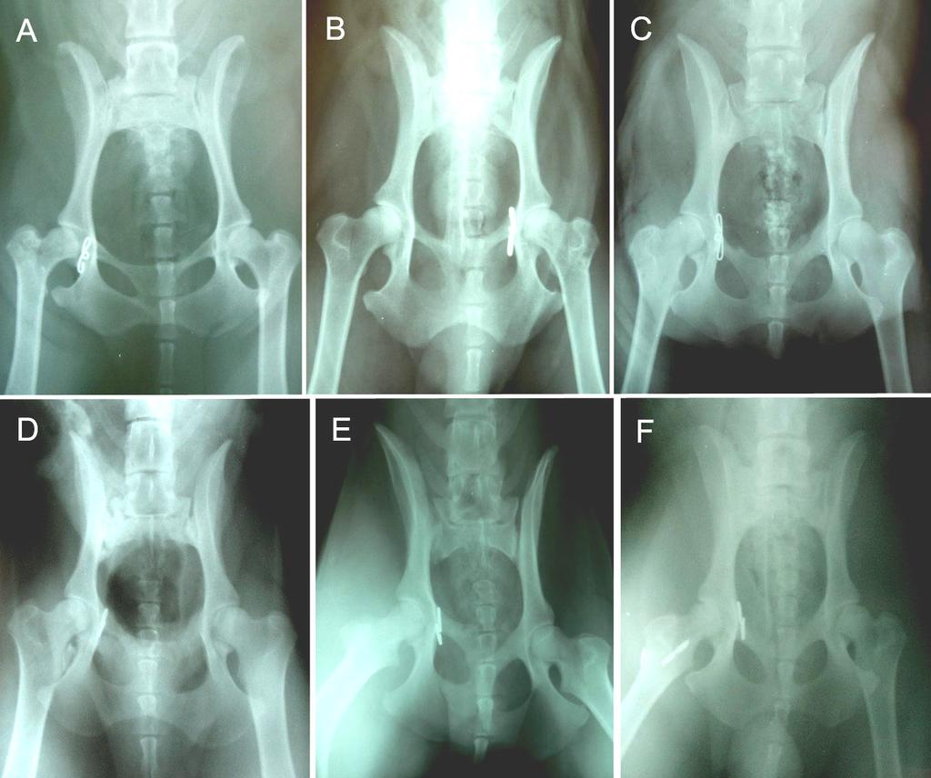 60 Şekil 3.10. Bazı olguların postoperatif ileri dönem radyografik görünümleri; (A) olgu 2, (B) olgu 5, (C) olgu 11, (D) olgu 19, (E) olgu 22, (F) olgu 25. Şekil 3.11. Postoperatif olarak, (A) 6.