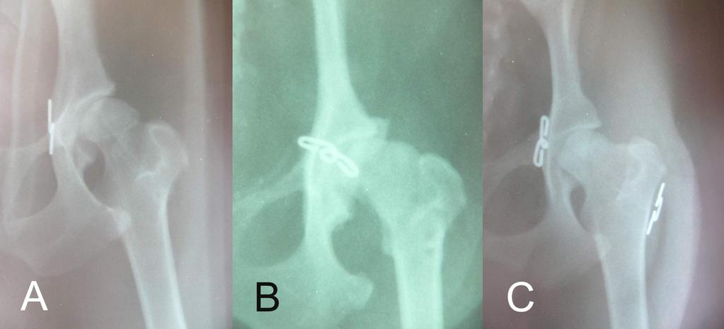 Köpeklerde radyografik değerlendirmelerde; 2, 5, 11, 19, 22 ve 25. olgularda coxofemoral eklemle ilgili olumsuz herhangi bir bulguya rastlanmazken (Şekil 3.