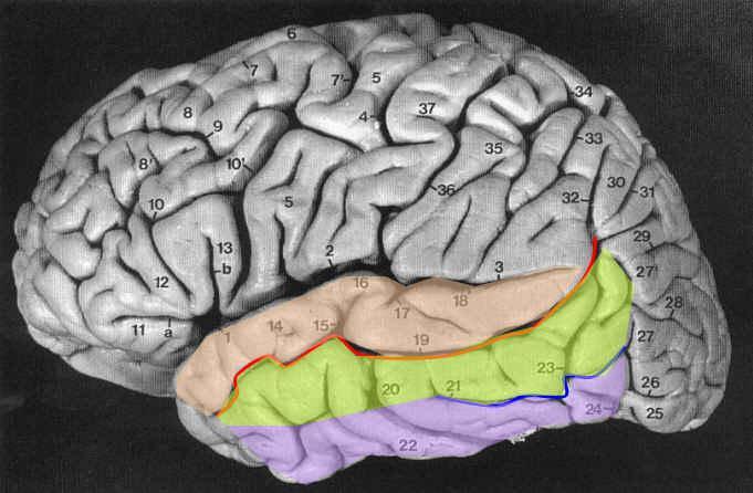 Lobus temporalis (Sulcus lateralis in aşağısında) Dışyan yüzde 2 sulcus, 3 gyrus vardır Sulcus temporalis