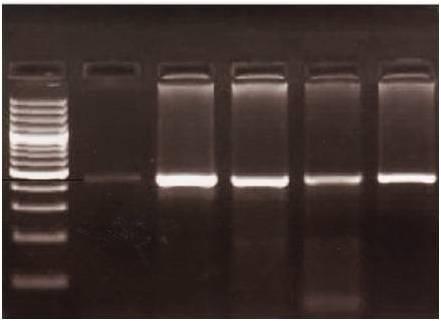 POLİMERAZ ZİNCİR REAKSİYONU* (PCR = Polymerase Chain Reaction)