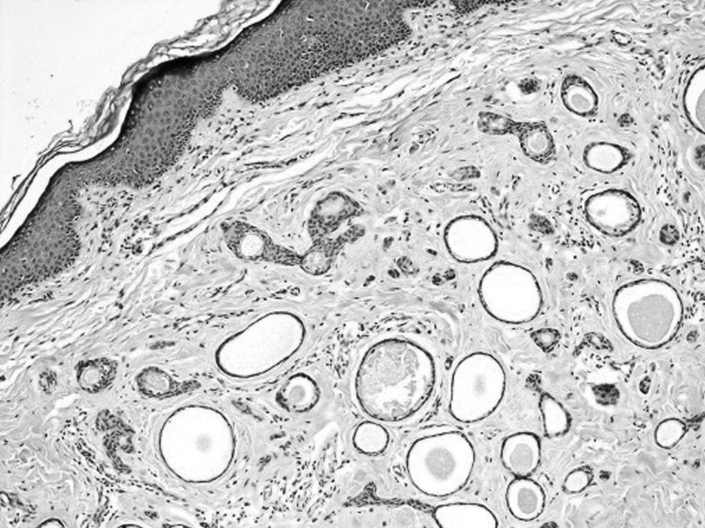 The result of the systemic examination was also unremarkable. Written informed consent was obtained from the patient for publication of this brief case report and the accompanying images.