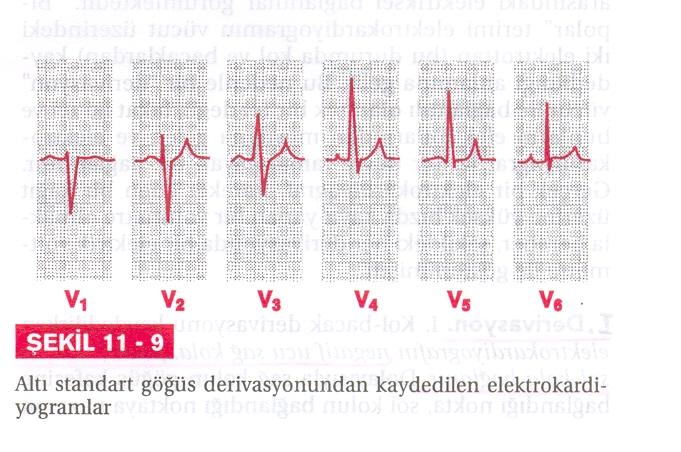 Ünipolar prekordial (V1-V6)