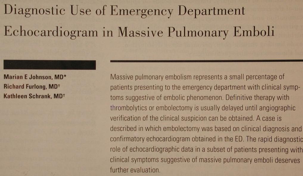 Pulmoner emboli Normalde RV/LV: 0.