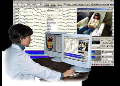 endikedir. Diğer Monitorizasyon Yöntemleri EEG Elektroenselografi: Beyindeki elektriksel potansiyelin değerlendirilmesinde kullanılır.