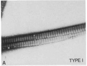 36 (a) Şekil 2.6. Tavuk embriyosu korneasında tip I ve tip V kollajen moleküllerinin transmisyon elektron mikroskobu görüntüsü [136] a) Tip I Kollajen b) Tip V Kollajen Tip I kollajen, diğer