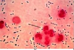 Streptococcus pneumoniae Gr (+) diplokok Polisakkarit yapıdaki kapsüle göre