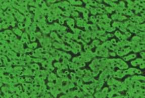 Böbrek kesiti: Proksimal tübüllerdeki hücrelerin sitoplazmalarının boyandığı, distal tübüllerdeki hücrelerin boyanmadığı görülür.