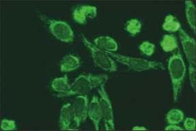Granülosit içeren HEp-2 hücreleri (x40) Etanol fikse granülositler: canca paterninde sitoplazmada dağınık granüller şeklinde floresan boyanma gözlenir.