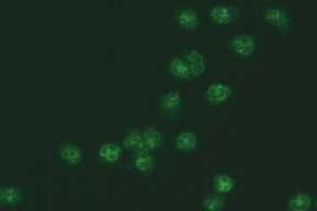 10.9.2. ANA (nükleer membran) pozitifliği 10. SİSTEMİK VASKÜLİTLER VE TANIDA KULLANILAN OTOANTİKORLAR Mikroskobik görünüm İlgili antijenler İlişkili olduğu hastalıklar Resim 10.9.2.1. Etanolle fikse granülositler (x40) RAPOR ÖRNEĞİ Sonuç Çalışma yöntemi Çalışılan hücre/doku Referans değer Açıklama/öneri Resim 10.