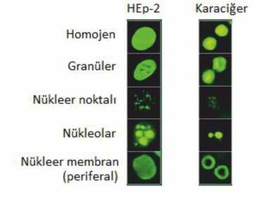 3. ANTİ-NÜKLEER ANTİKOR (ANA) SAPTANMASINDA İNDİREKT İMMÜNOFLORESAN (IIF) YÖNTEMİ VE STANDARDİZASYON Şekil 3.4.