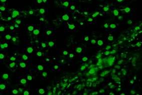 ANTİ-NÜKLEER ANTİKOR (ANA) PATERNLERİ Mikroskobik görünüm İlgili antijenler İlişkili olduğu hastalıklar Resim 5.1.1.3.