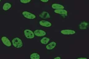 ) HEp-2 interfaz evresindeki hücreler: Pozitif İstirahat halindeki hücrelerin nükleusları kumlu ve bazen homojene benzeyen ince benekli (ince granüler, fine speckled)