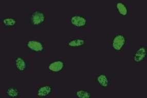 HEp-2 metafaz evresindeki hücreler: Negatif Metafaz evresindeki hücrelerdeki kromatinlerde boyanma gözlenmez (metafaz evresindeki hücrelerin orta hatları boş görülür).