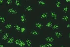 HEp-2; interfaz ve metafaz görüntüsü (büyütülmüş görüntü) HEp-2 interfaz evresindeki hücreler: Pozitif İstirahat halindeki HEp-2 hücrelerinin