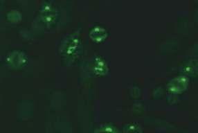 Maymun karaciğeri (x40) HEp-2 interfaz evresindeki hücreler: Negatif/Pozitif MSA-1'de istirahat halindeki hücrelerin nükleoplazmasında ince