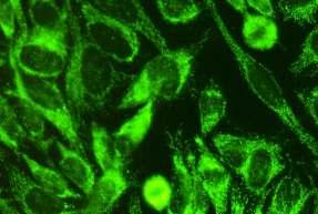 1.4. Maymun karaciğeri (x40) HEp-2 hücreleri: Nükleusun çevresinde daha yoğun olmak üzere tüm sitoplazmada