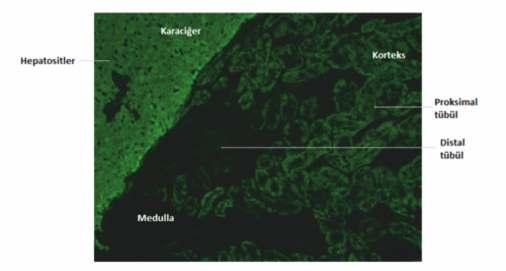 Tip 2 OİH'lerin bir göstergesi olan anti-lkm antikorlarının varlığında sıçan böbreğinde proksimal tübüllerin boyandığı, ancak distal tübüllerin boyanmadığı dikkati çeker (Şekil 7.2.12.