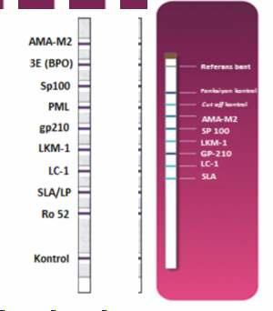 Anti-karaciğer sitozolik antijen-1 (anti-lc-1): Tip 2 OİH tanısında önemli bir parametre olan anti- LC-1 antikorları hepatosellüler inflamasyonun önemli bir göstergesidir.