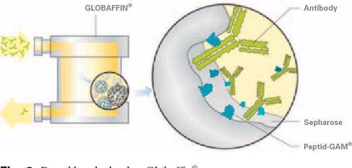 Plazma değişimi ve İmmunabsorbsiyon + Antijen spesifik + Plazma protein