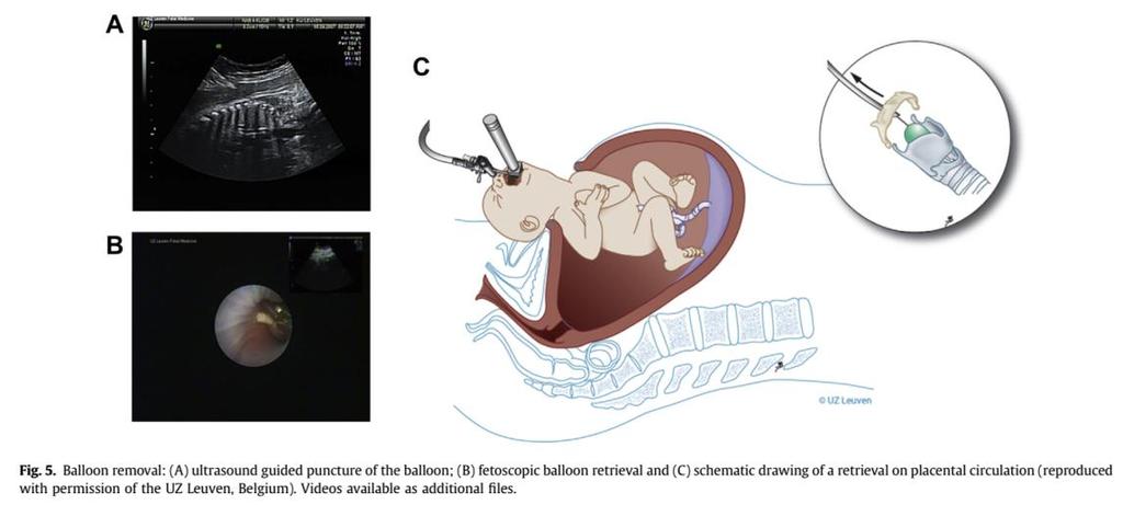 congenital