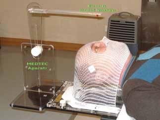 Göz çukuru ve göz içi tümörlerinin CyberKnife ile tedavisinde basit bir sabitleme ve izleme yöntemi Şekil 2. Hasta simülasyon set-up düzeni. def noktasından oluşmaktadır (Şekil 2).