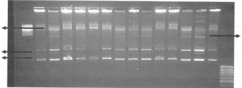 Mupirosine fenotipik olarak dirençli bulunan 35 MRSA suşunda meca ve mupa direnç genleri PCR ile araştırılmış ve tüm izolatlarda meca ve mupa geni saptanmıştır (Resim 1).