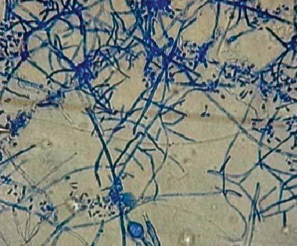 Saçlar steril petrilere dağıtılır, üzerine dermatofit kökeni eklenir ve 28 C de 30 gün süre ile inkübasyona bırakılır ve test edilen kökenin kılı delip delmediği; laktofenol pamuk mavisinin