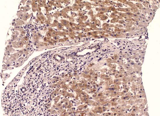 15 (Tablo 1, 2) Karaciğer iğne biyopsisi içeren bloklardan hazırlanan kesitler deparafinize ve rehidrate edildikten sonra, MMP-2 (Ab- 3, monoclonal mouse, clone: 42-5D11, Oncogene), MMP-9 (Ab-3,