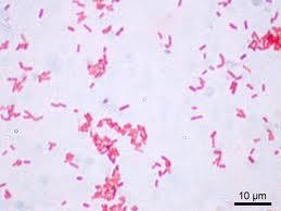Enterobakteriler Nerelerde bulunur?