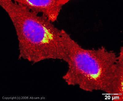 Golgi sisternalarında iki farklı mannoz -6-fosfat reseptörü