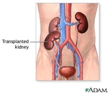 Renal transplantlarda graft ömrünün uzaması büyük randomize çalışma ile gösterilmişse de daha sonraki çalışmalar