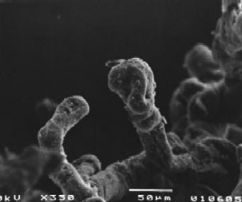Figür 4: Stem villuslara ait taramal elektron mikroskopisi görüntüsü. x200 büyütme(sem). Figür 5: Plasenta, maternal yüz.