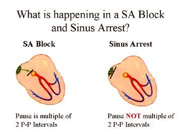 Sinus