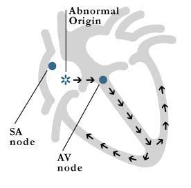 Atrial