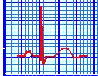 EKG FĠZYOLOJĠSĠ SĠNOATRIYAL NOD: 0.00 sn ATRIYAL DEPOLARĠZASYON: 0.04-0.08 sn P süresi : 0.