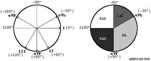 Axis Aks QRS komplekslerinin depolarizasyon yönüdür(vektör). Sol ventrikül kalınlaşır, kasılır bu yüzden QRS vektörü aşağı ve soladır.
