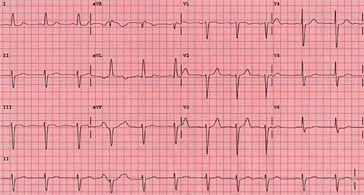 Figure 30: Left axis