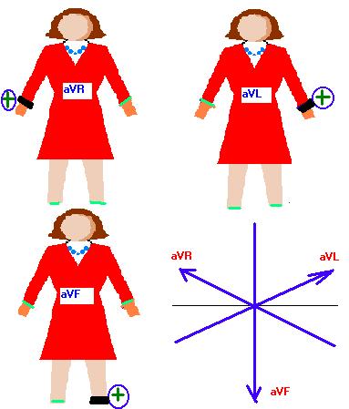 STANDART DERĠVASYONLAR avr, avl, avf avr: