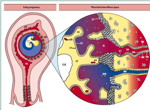EVRE 1 Endometrium ve iç myometrium hazırlanmasında zayıflık Yetersiz trofoplast invazyonu Zayıf spiral arter adaptasyonu İskemik reperfüzyon Plasental oksidatif ve Endoplazmik retikulum